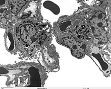 Alveolar sac region of the lung - TEM Alveolar sac region of the lung - TEM.jpg