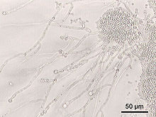 Candida albicans, a dimorphic fungus that grows as a yeast in the gut Candida albicans.jpg