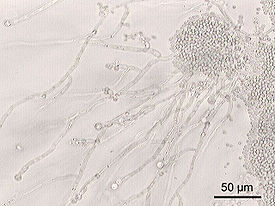 Candida albicans (увеличено в 200 раз)