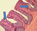 Miniatura para Membrana bacteriana esterna