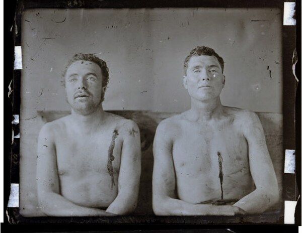 Bodies of Clell Miller and Bill Chadwel