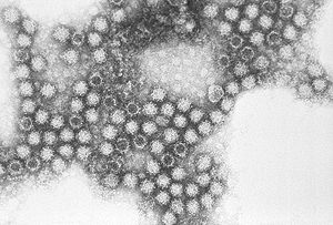 Electron micrograph of "Feline calicivirus" virions