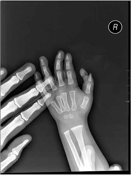 File:Medical X-Ray imaging MYL06 nevit.jpg