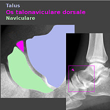 os talonaviculare dorsale - Wikidata