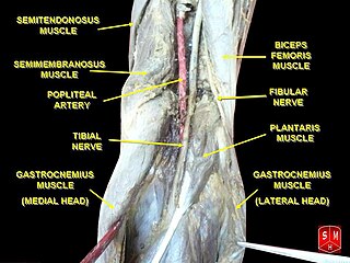 Popliteal artery entrapment syndrome Medical condition