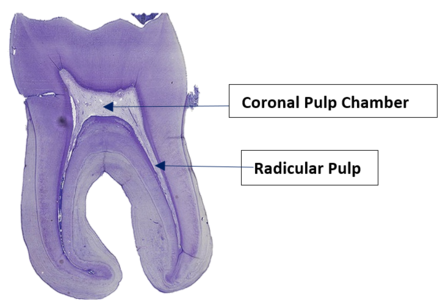 Pulp Tooth Wikiwand