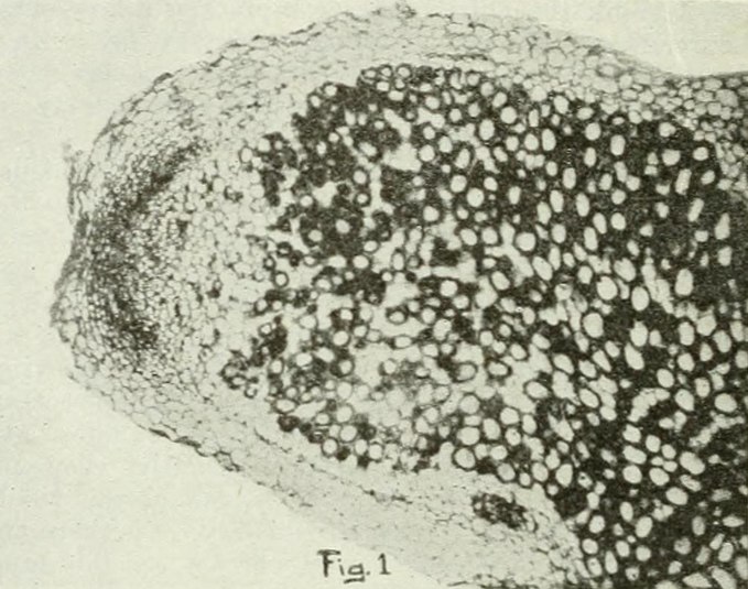 File:Trifolium repens root nodule.tif