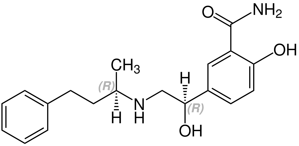 Labetalol - wikidoc