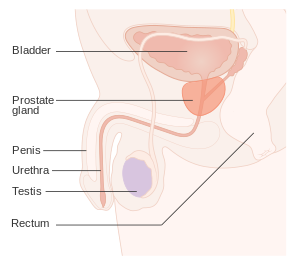 forma cronică a cursului prostatitei prostatita si ozonoterapia
