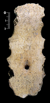 Vignette pour Foramen sternal