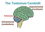 Thumbnail for Cerebellar tentorium