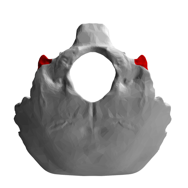 File:Jugular process of occipital bone - close-up11.png - Wikimedia Commons