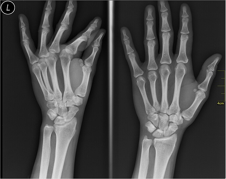 File:Medical X-Ray imaging QLQ06 nevit.jpg