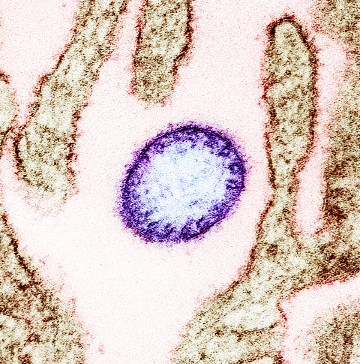 1200px Nipah virus from an infected VERO cell