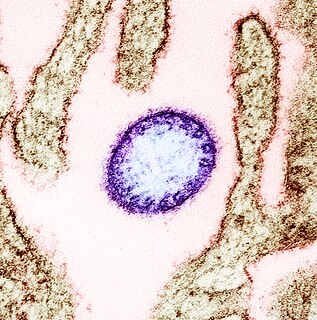 Nipah virus Species of virus