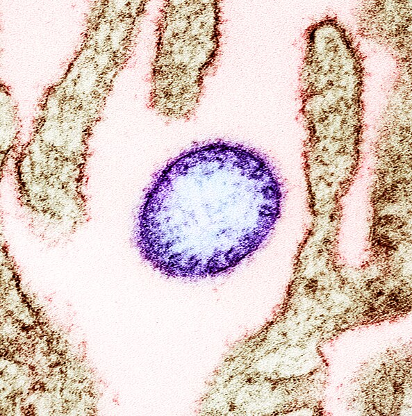 File:Nipah virus from an infected VERO cell.jpg