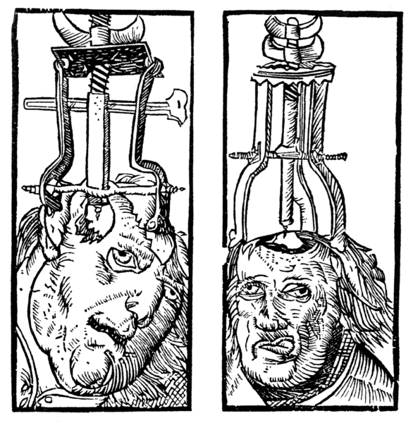 File:Peter Treveris - engraving of Trepanation for Handywarke of surgeri 1525.png