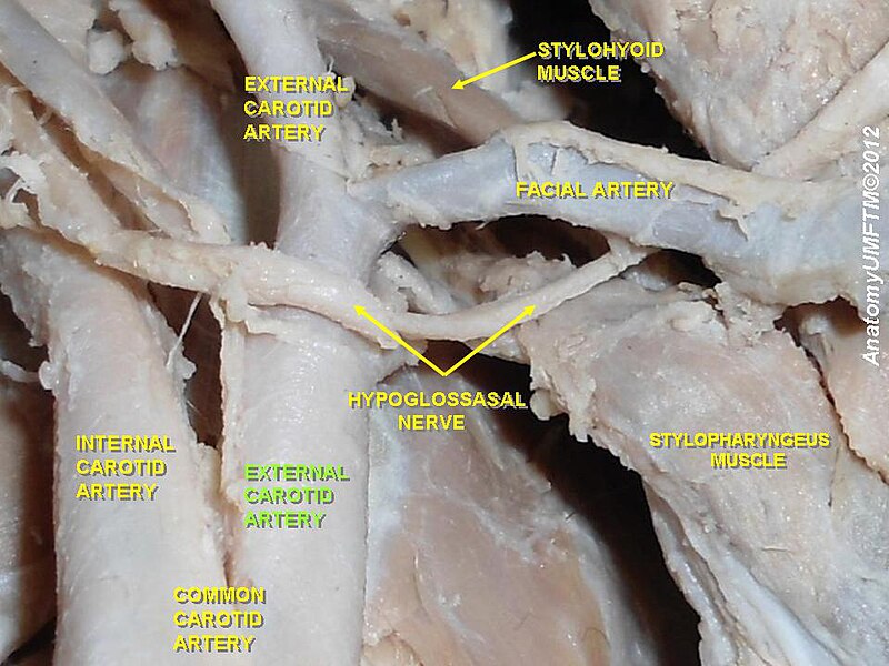 File:Slide2aaa.JPG