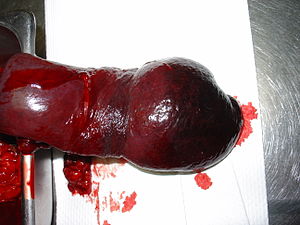 Splenic necrosis.JPG