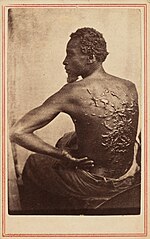 Thumbnail for File:The Scourged Back, c. 1863.jpg