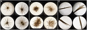 picture of different shapes of the marine phytoplankton Trichodesmium