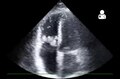 File:UOTW 60 - Ultrasound of the Week 1.webm