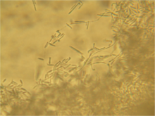 Ustilago maydis haploid sporidia Ustilago maydis haploid sporida 160X.png