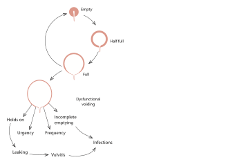 Continence Management Flow Chart