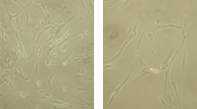 WI-38 cells (Left: in high density. Right: in low density) WI-38-Li-and-Tollefsbol-2011.gif