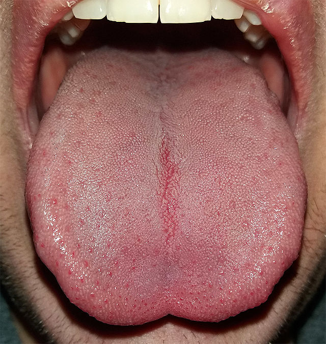 healthy tongue side