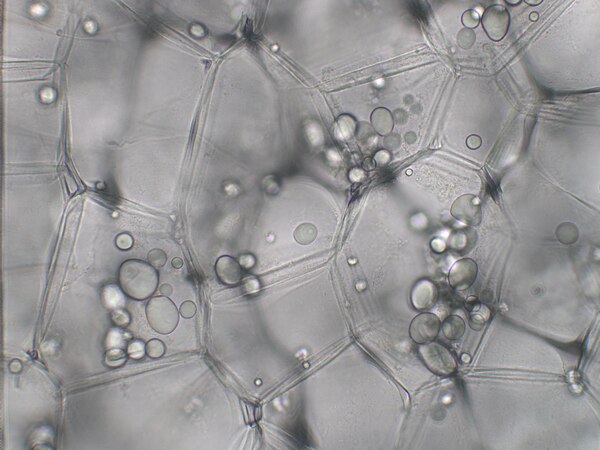 Leucoplasts in plant cells.