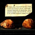 P02615: Bladder stones and cockleshells（P02615号展品：膀胱结石和海扇壳）