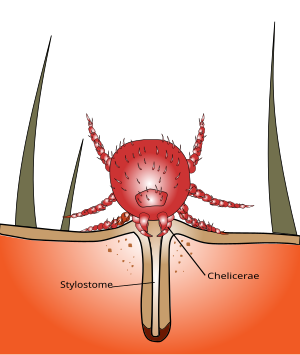 Chigger Bite.svg