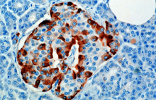 A microscopic image stained for glucagon Glucagon rednblue.png