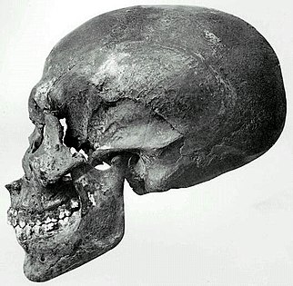 Crâne attribué à Akhenaton.[réf. nécessaire]