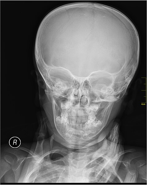 File:Medical X-Ray imaging TVP07 nevit.jpg