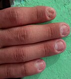 Spiritual Meaning of Nail Biting: 10 Powerful Meanings (By Betty)-totobed.com.vn