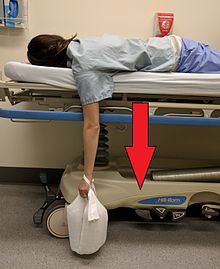 An example of Stimson maneuver. The person is lying on their stomach with a 4 kg weight tied to their wrist. Stimson2017.jpg