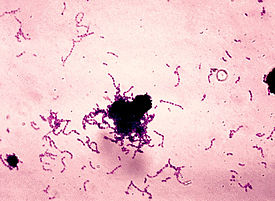 Файл:Streptococcus pneumoniae.jpg