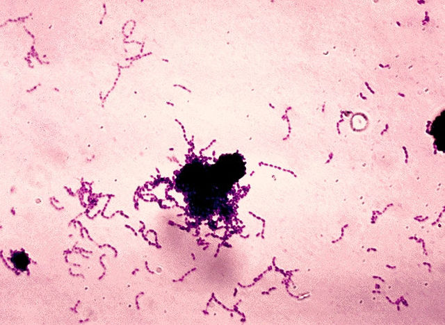 streptococci gram stain