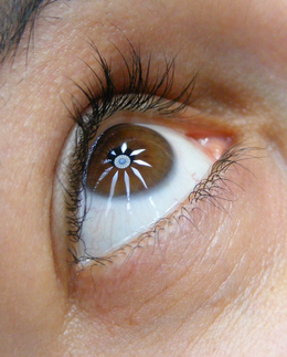 Odraz/refleksija u oku