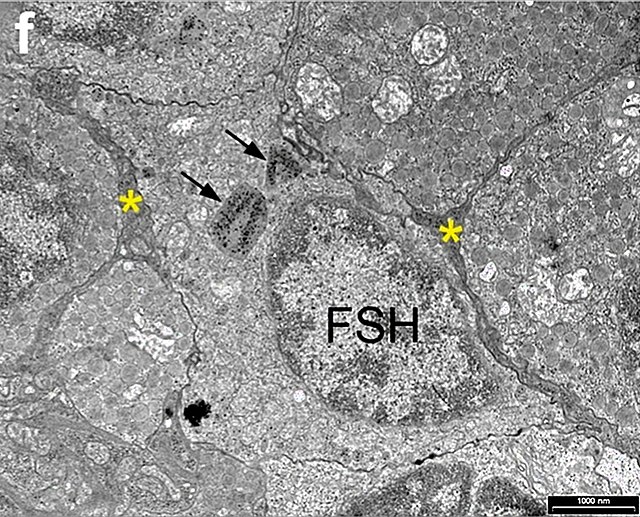 An image of the Gonadotropic cell