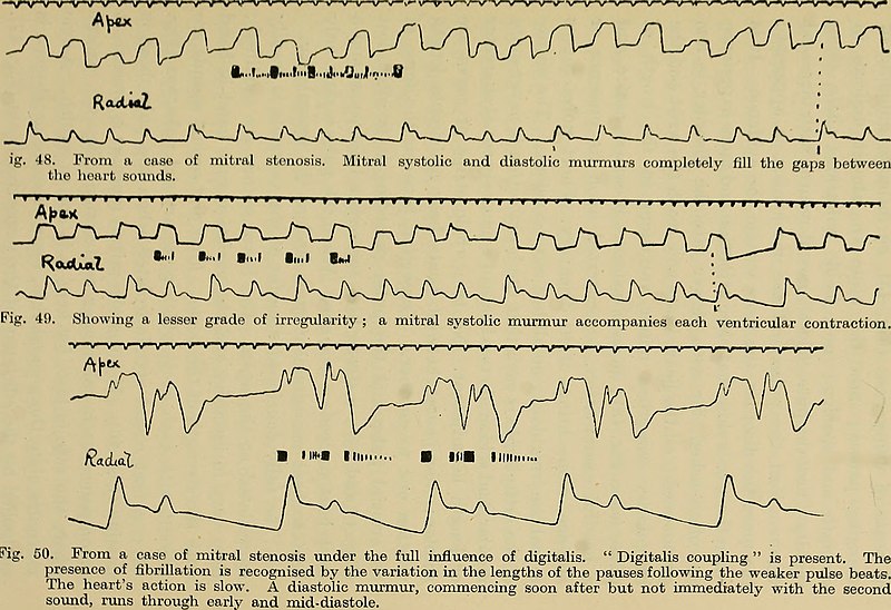 File:Clinical disorders of the heart beat - a handbook for practitioners and students (1916) (14760795354).jpg
