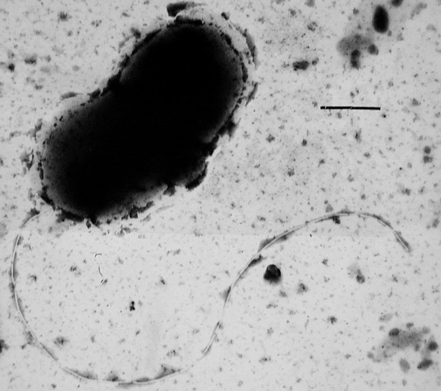 Desulfovibrio vulgaris is the best-studied sulfate-reducing microorganism species; the bar in the upper right is 0.5 micrometre long.