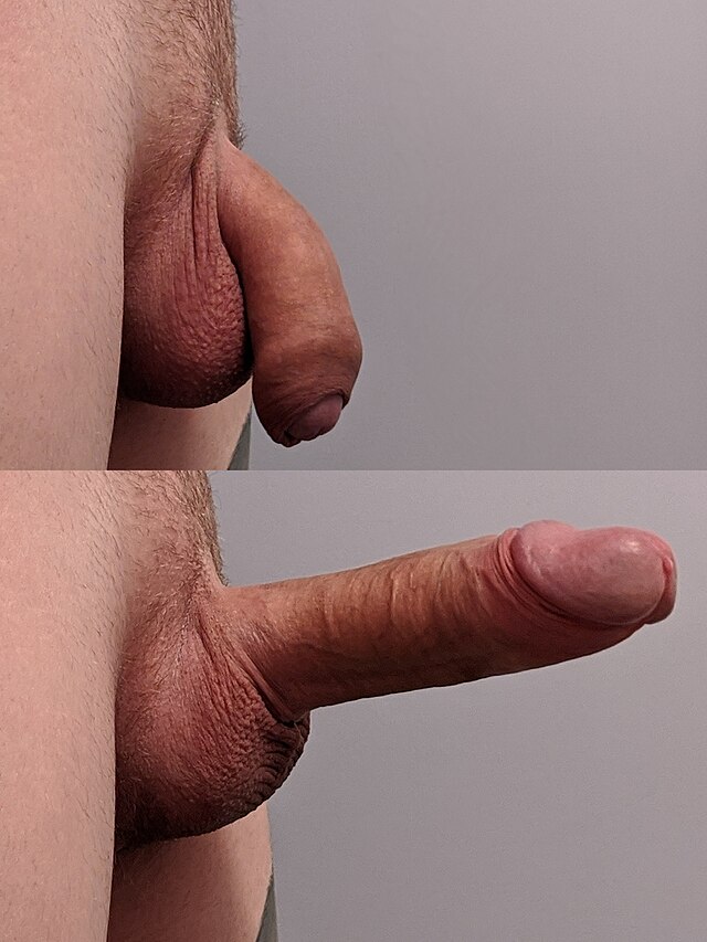 Fayl:Flaccid and erect uncircumcised penis.jpg - Vikipediya.