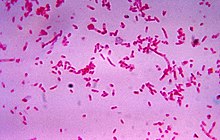 "Fusobacterium novum" in liquid culture