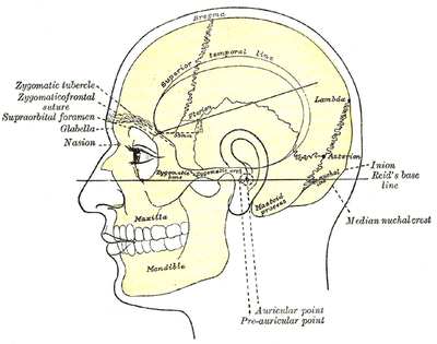 Mastoiditis