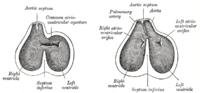 Thumbnail for Aorticopulmonary septum