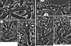 Grzyby Skórka: Budowa makroskopowa, Budowa mikroskopowa, Galeria obrazów mikroskopowych skórki grzybów