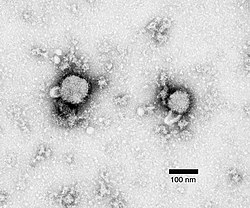Negative stain electron micrograph of an arenavirus from a mouse that tested positive for LCM